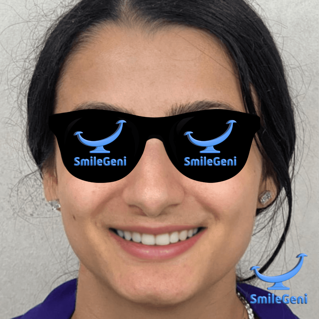 Case 10 — After SmileGeni 2D