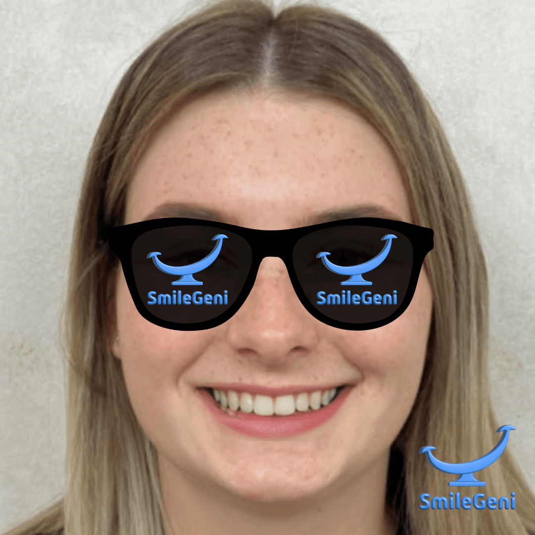 Case 7 — After SmileGeni 2D